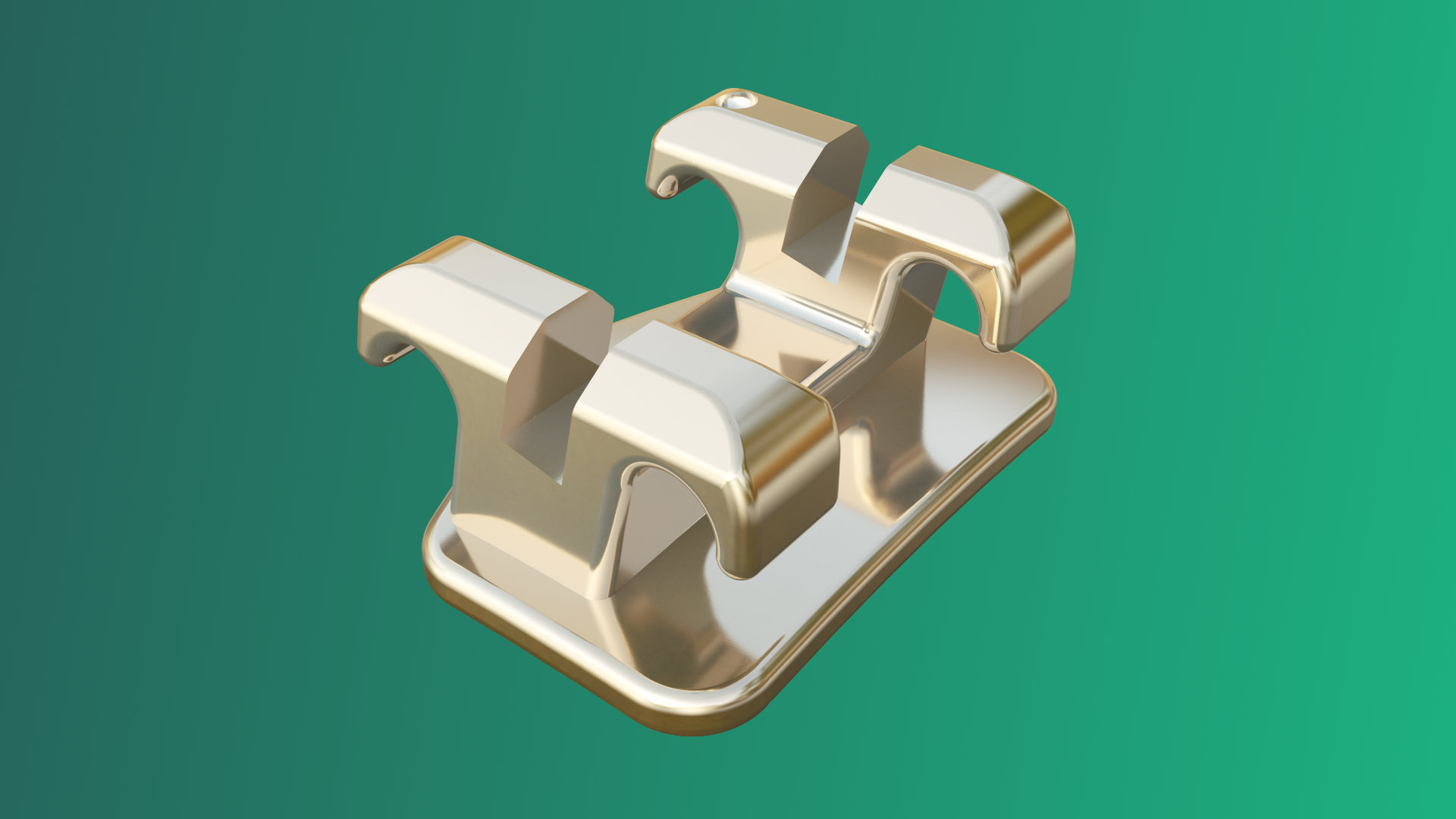 Iconix Champagne Gold Braces treatment result
