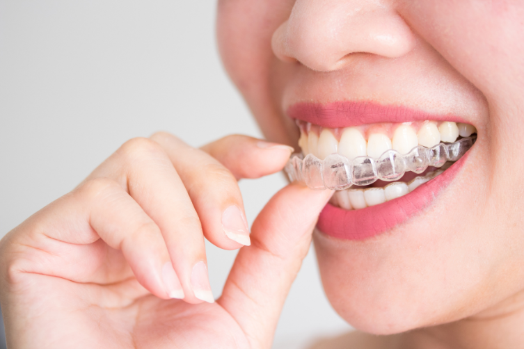 Transform Your Smile with Modern, Affordable Braces for Kids, Teens, and Adults