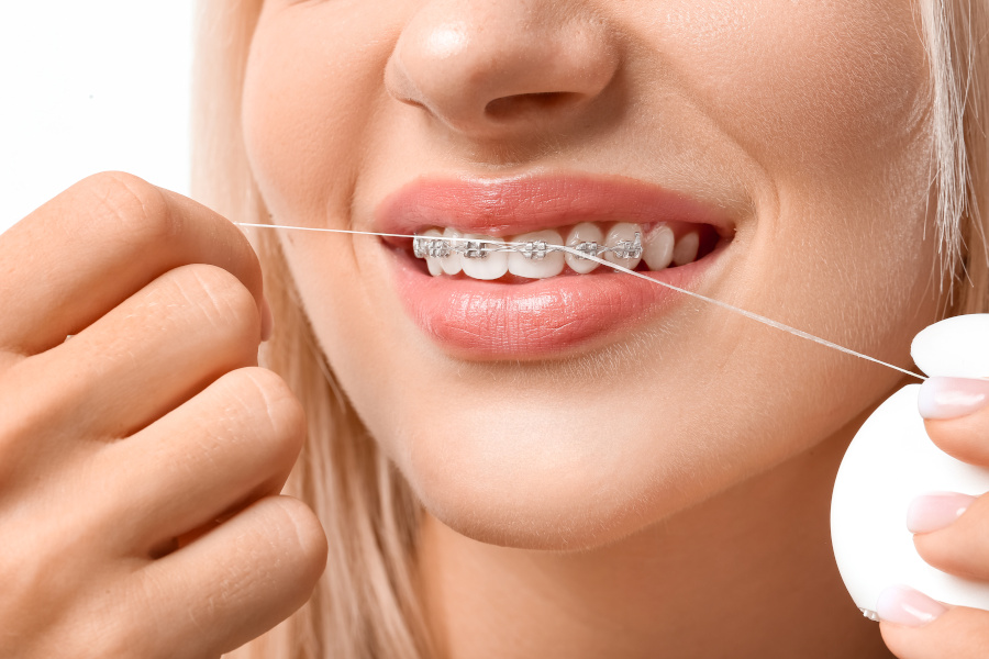 If you experience any bleeding when brushing or flossing...